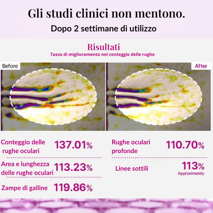 Patch Occhi al Calcio e Collagene