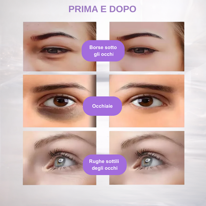 Luminia Eyes Pro -Terapia LED e EMS-